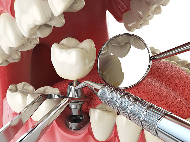 Best Emergency Treatment for Oral Infections in Goodlettsville, TN